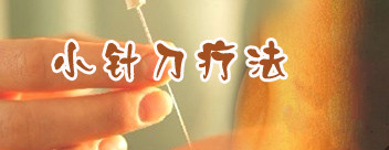 腱鞘炎疗法 腱鞘炎疗法
