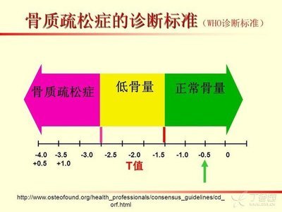 骨质疏松诊断.jpg 骨质疏松诊断.jpg