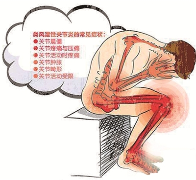 类风湿性疾病是什么原因造成的.jpg