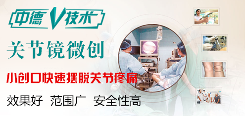 关节镜技术.png