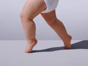 如何有效预防O型腿 如何有效预防O型腿