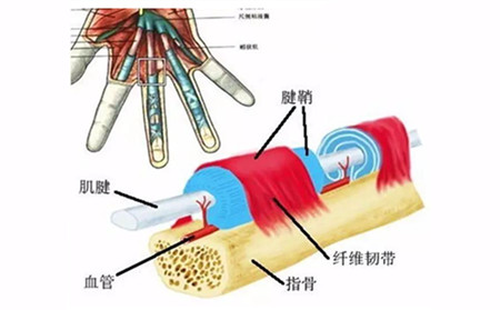 腱鞘炎.jpg 腱鞘炎.jpg